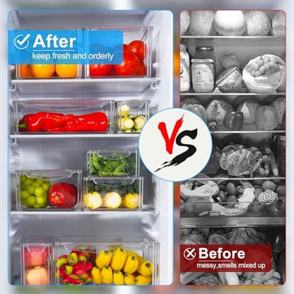 Pure Future 10-Pack Fridge Organizers and Storage Clear Container with Lids
