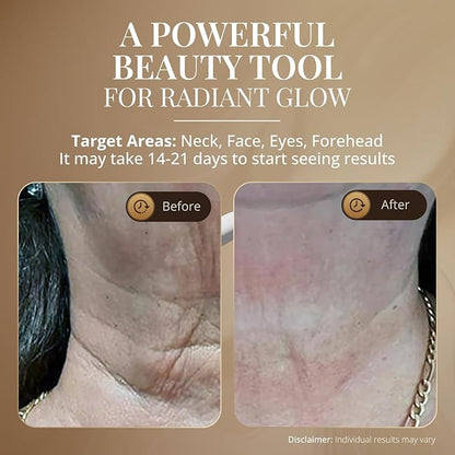 GLO24K Red Light for Face and Neck Beauty Device – Triple LED Action &